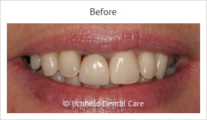 Patient case 3 before