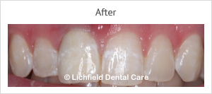Patient case 7 after