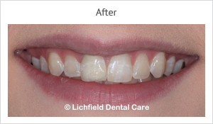 Patient case 8 after