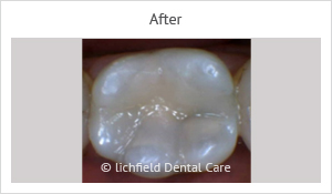 Patient case 3 after