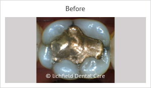 Patient case 3 before