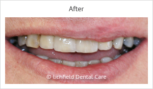 Patient case 1 before