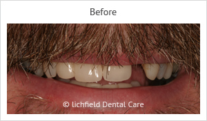 Patient case 2 before