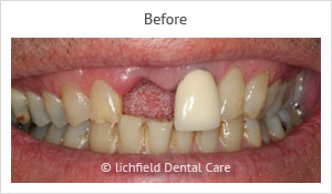 Patient case 4 before