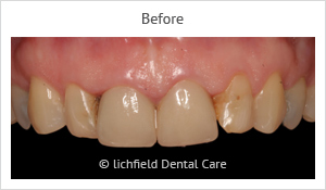 Patient case 2 before